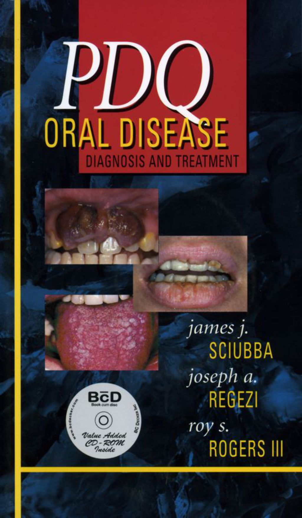 PDQ Oral Disease: Diagnosis and Treatment 1st Edition