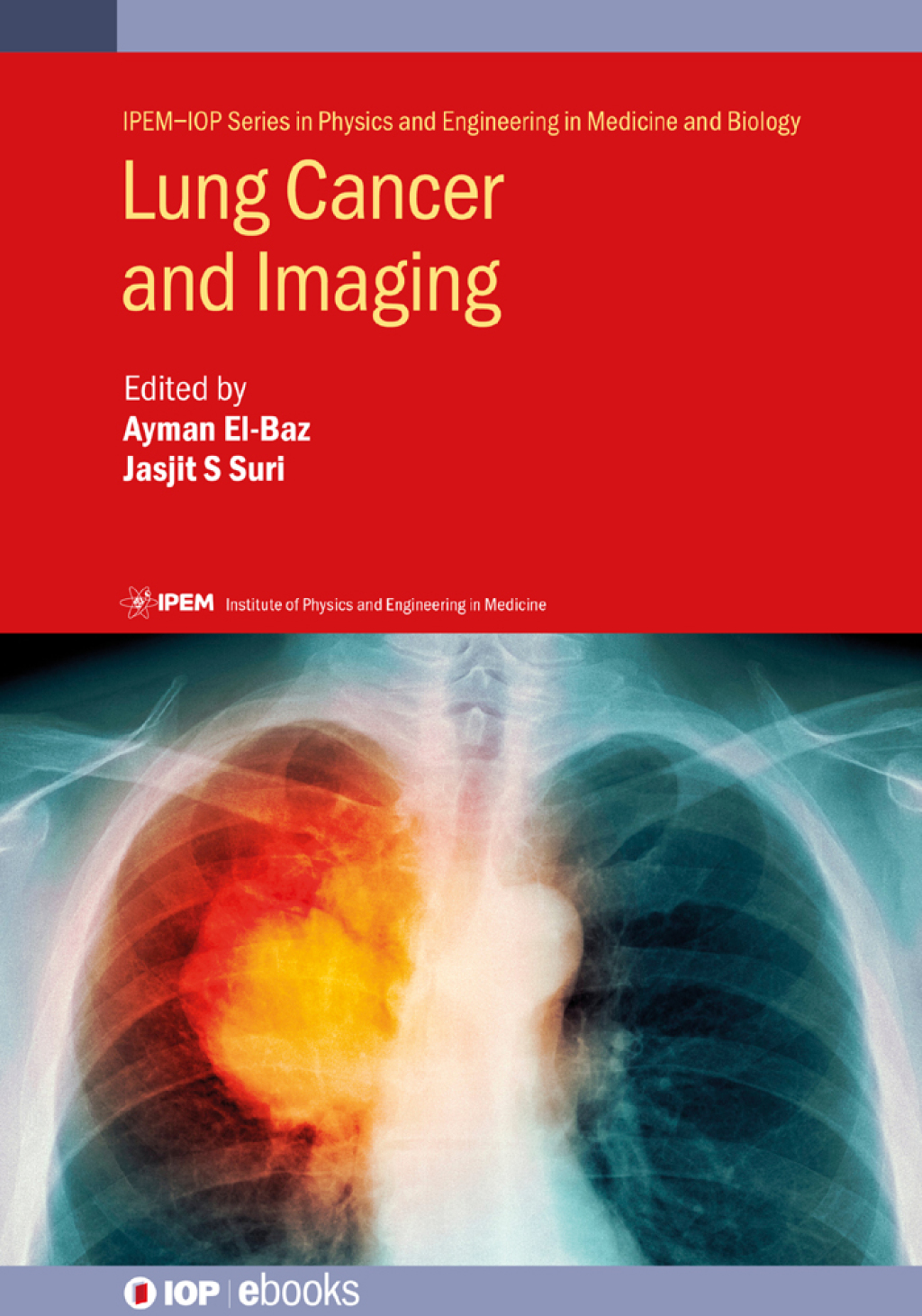 Lung Cancer and Imaging 1st Edition