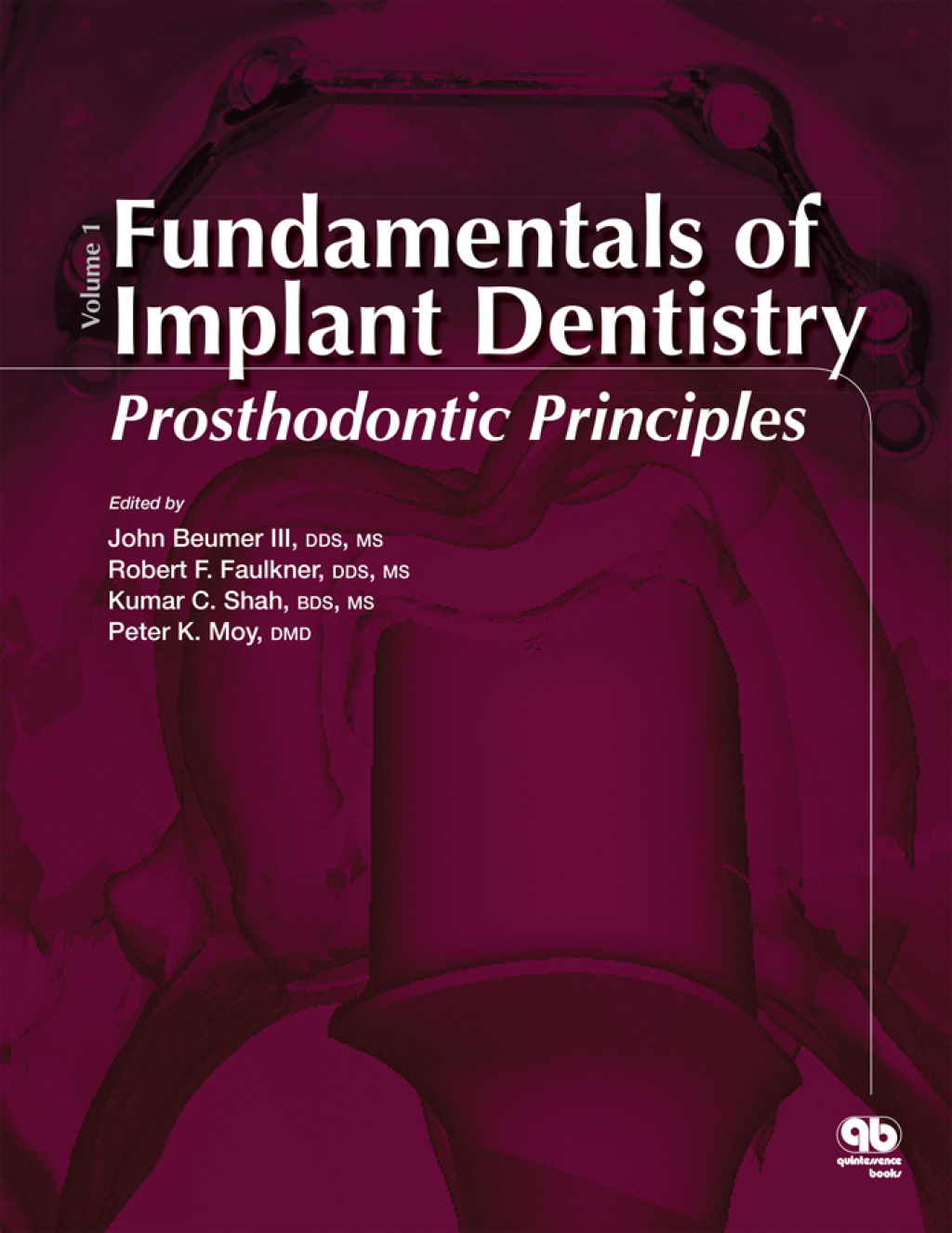 Fundamentals of Implant Dentistry, Volume 1: Prosthodontic Principles 1st Edition