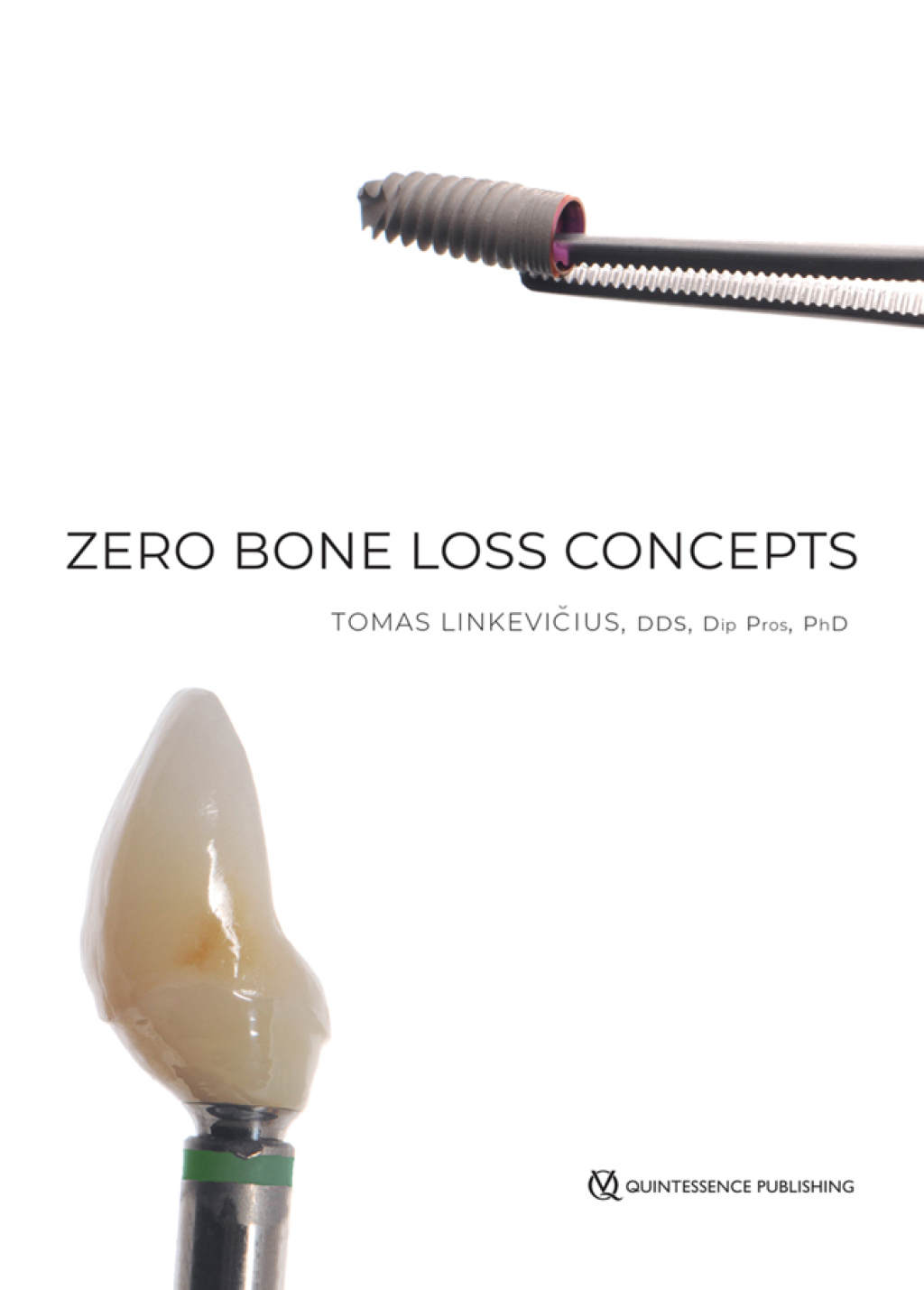 Zero Bone Loss Concepts 1st Edition
