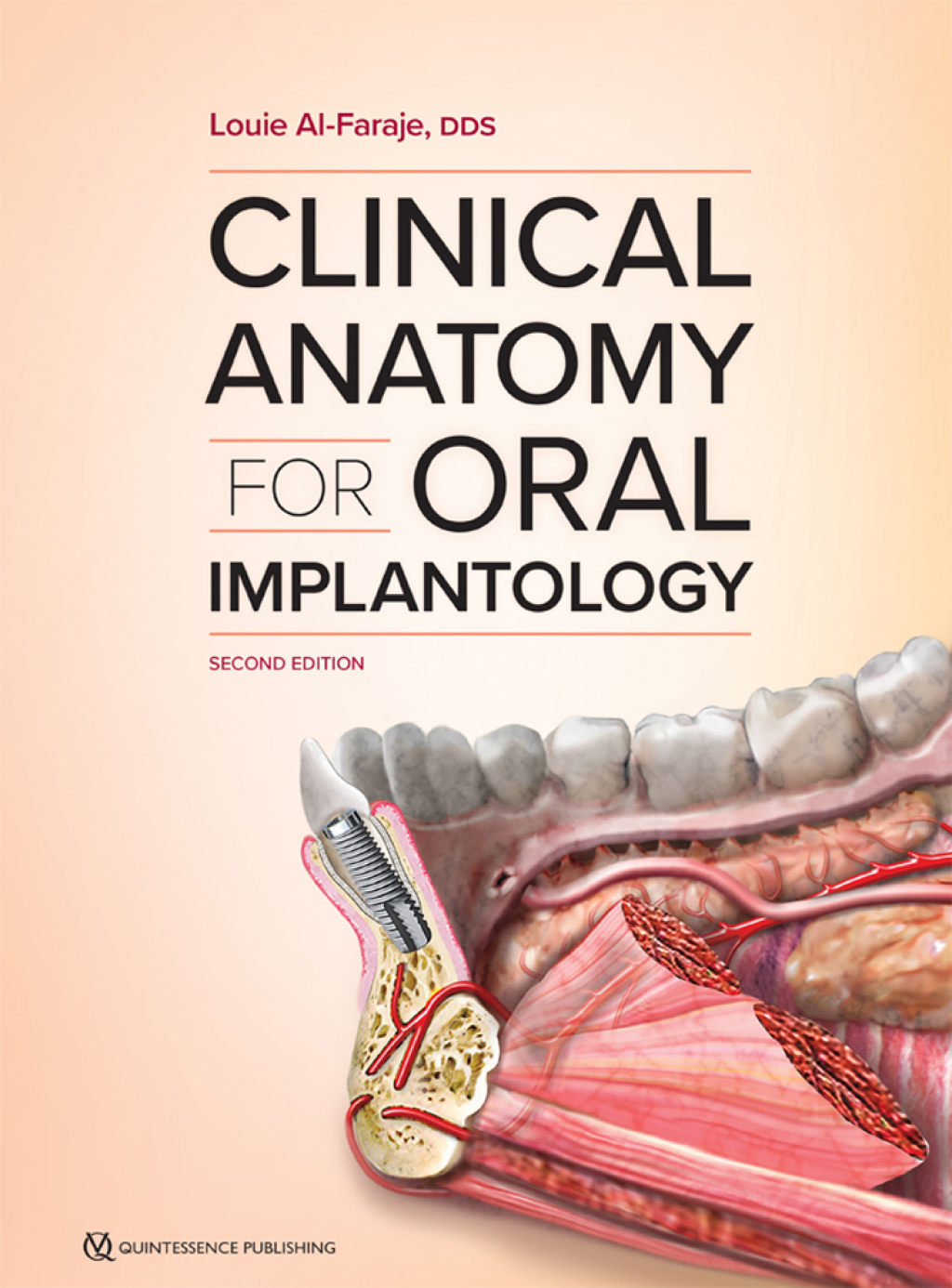 Clinical Anatomy for Oral Implantology, Second Edition 2nd Edition