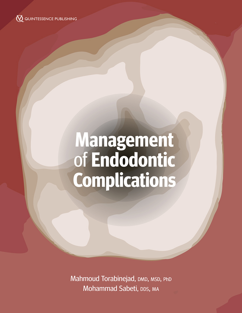 Management of Endodontic Complications: From Diagnosis to Prognosis 1st Edition
