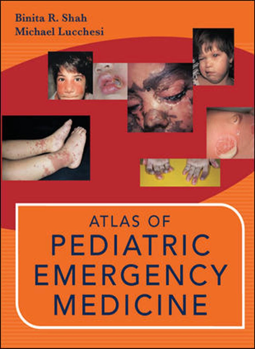 Atlas of Pediatric Emergency Medicine 1st Edition