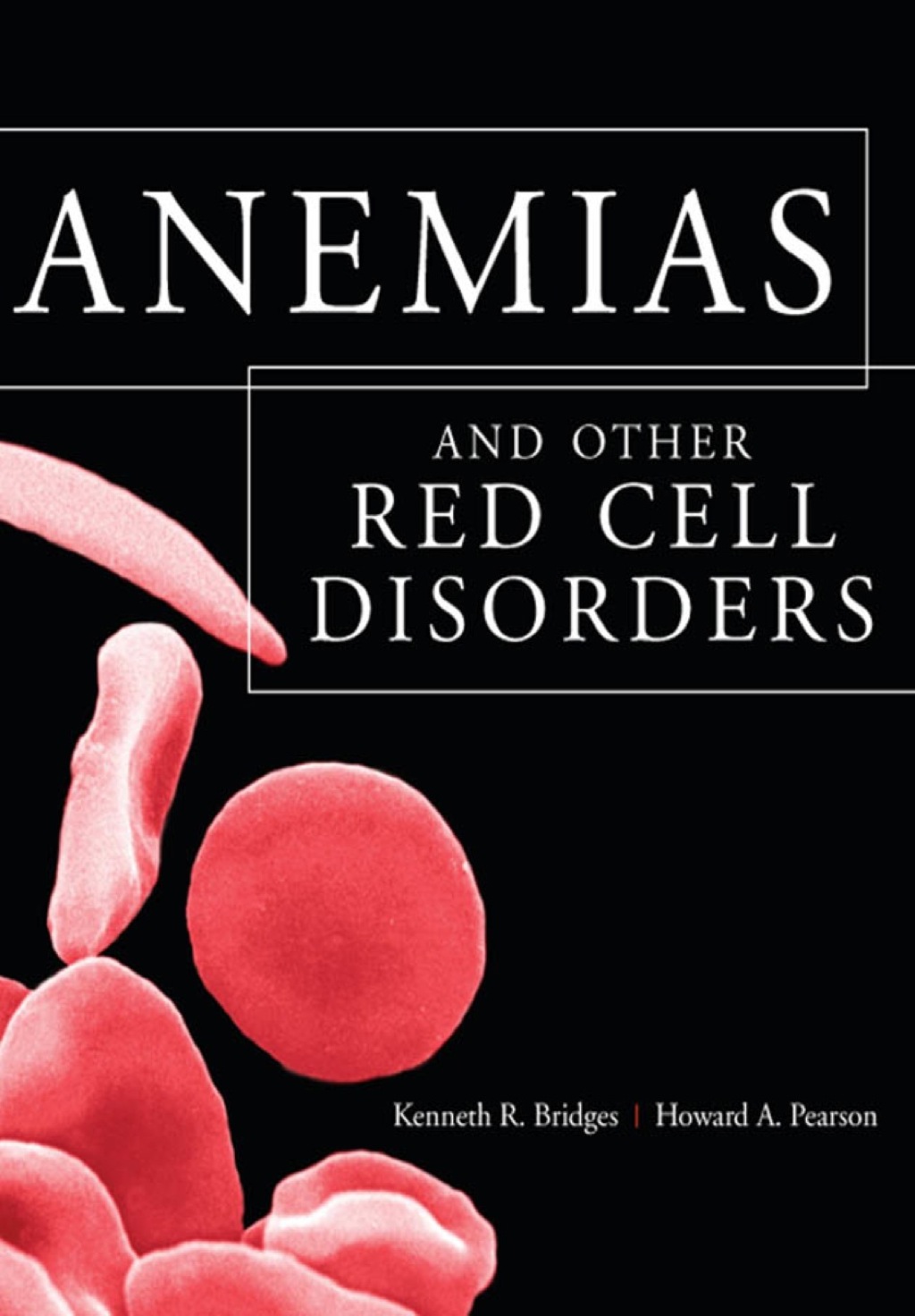 Anemias and Other Red Cell Disorders 1st Edition