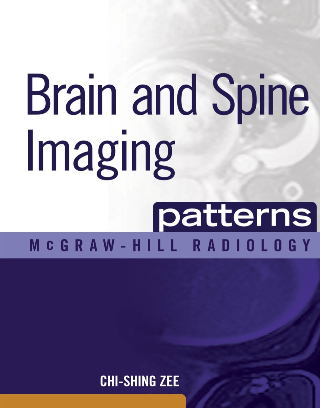 Brain and Spine Imaging Patterns 1st Edition