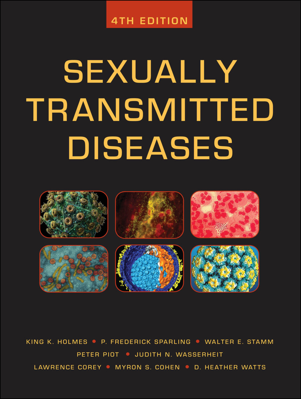 Sexually Transmitted Diseases, Fourth Edition 4th Edition
