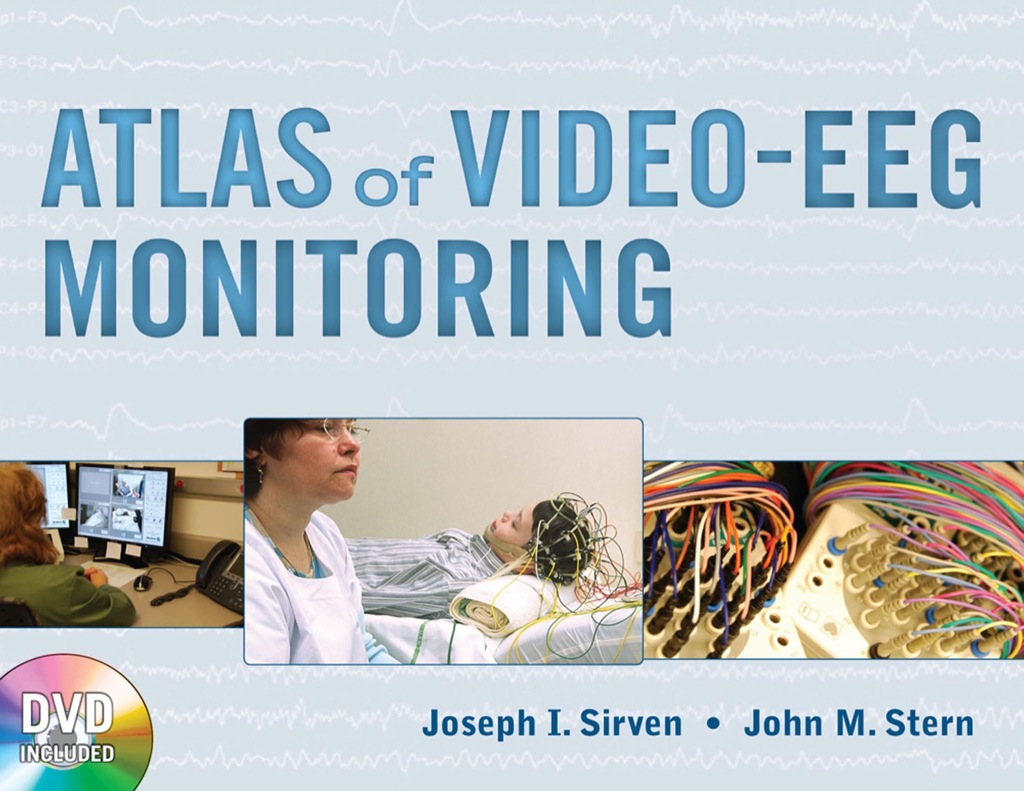 Atlas of Video-EEG Monitoring 1st Edition