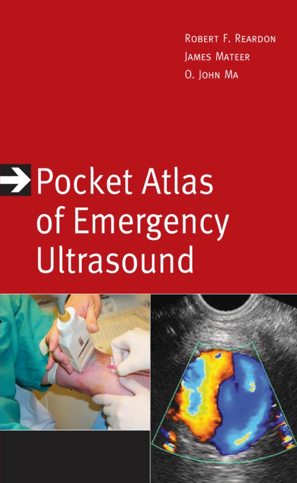 Pocket Atlas of Emergency Ultrasound 1st Edition