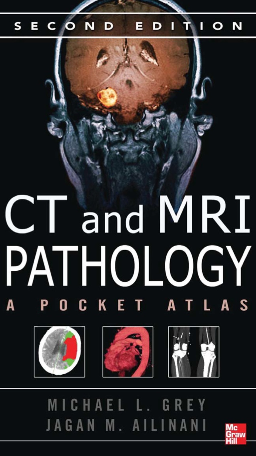 CT & MRI Pathology: A Pocket Atlas, Second Edition 2nd Edition