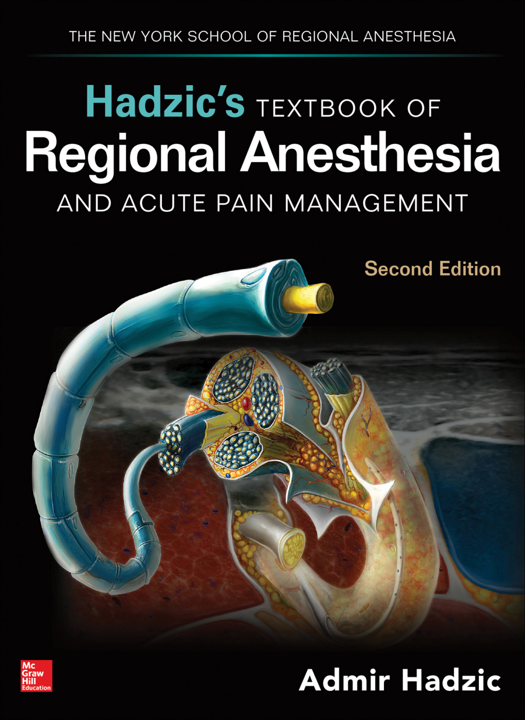 Hadzic's Textbook of Regional Anesthesia and Acute Pain Management 2nd Edition