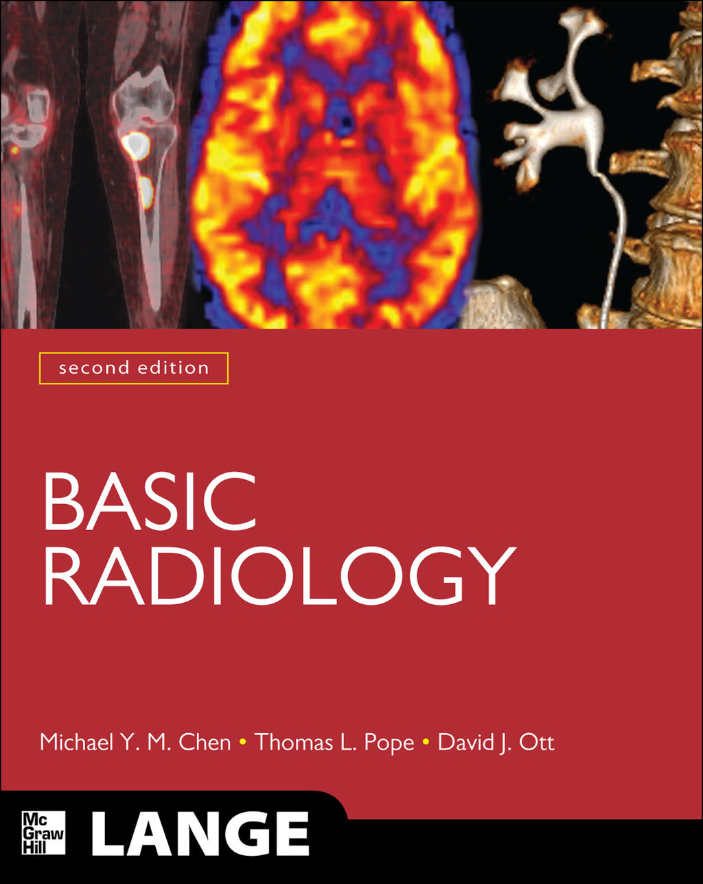 Basic Radiology, Second Edition 2nd Edition