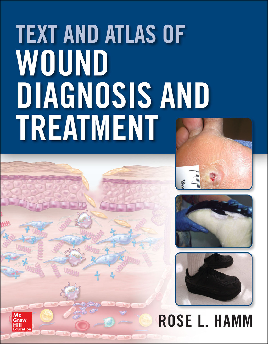 Text and Atlas of Wound Diagnosis and Treatment 1st Edition