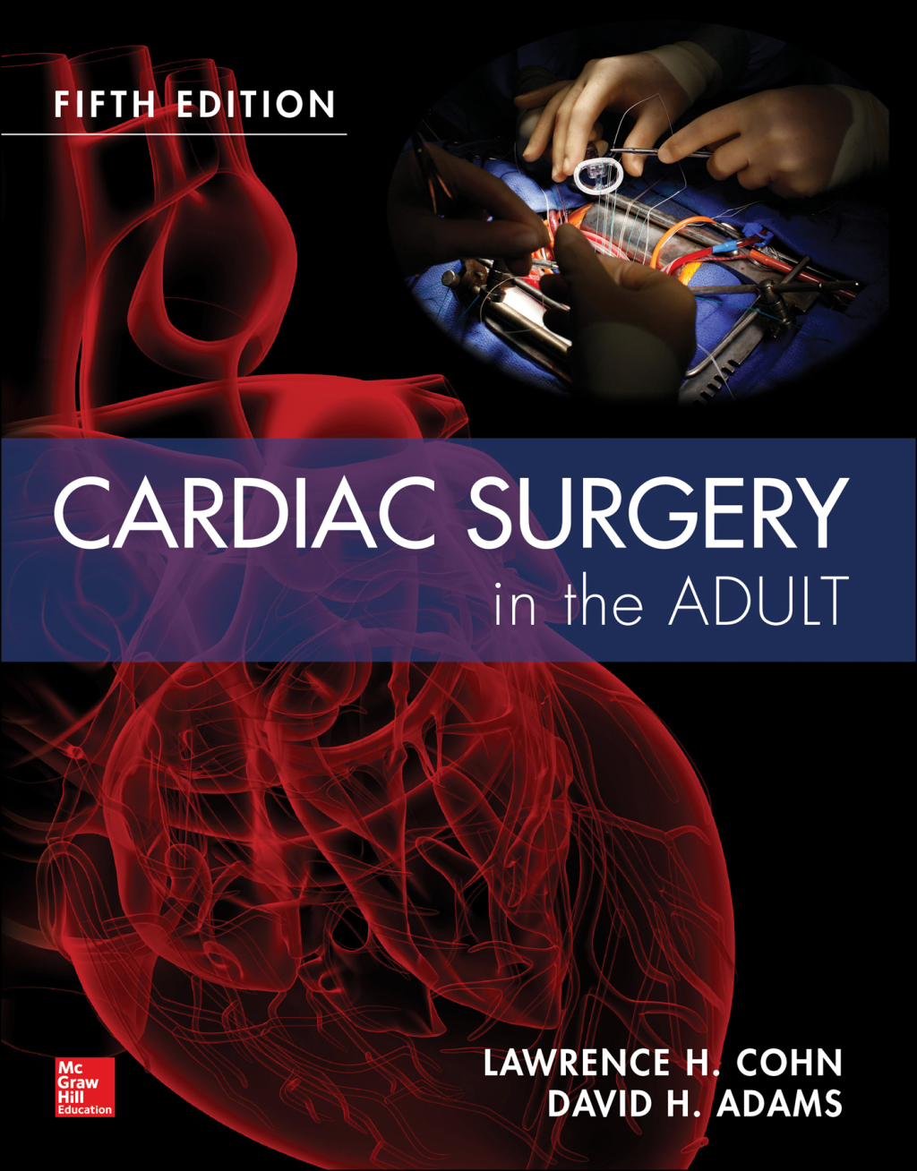 Cardiac Surgery in the Adult Fifth Edition 5th Edition