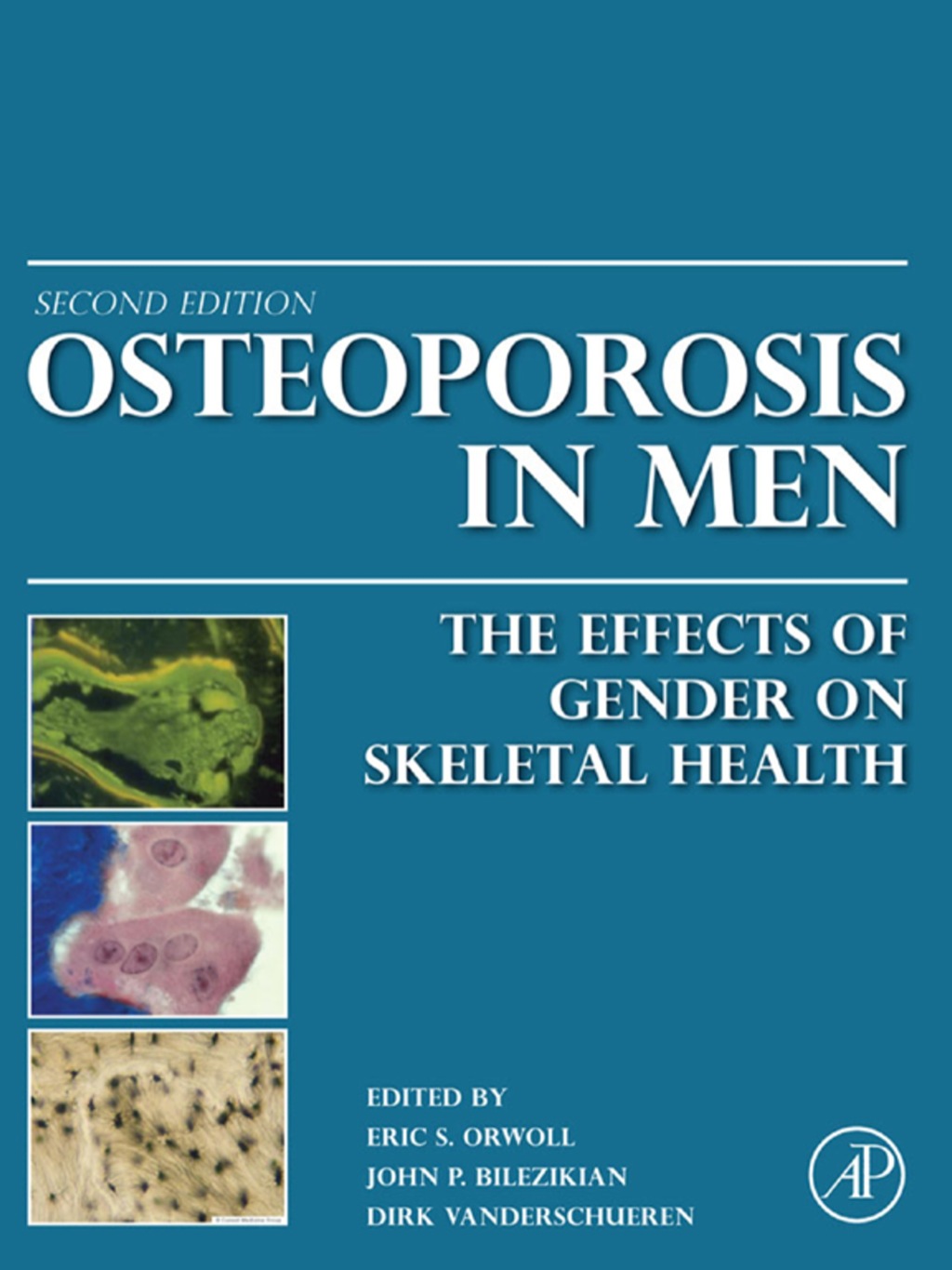 Osteoporosis in Men: The Effects of Gender on Skeletal Health 2nd Edition