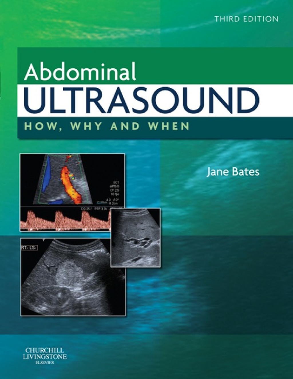 Abdominal Ultrasound How, Why and When 3rd Edition