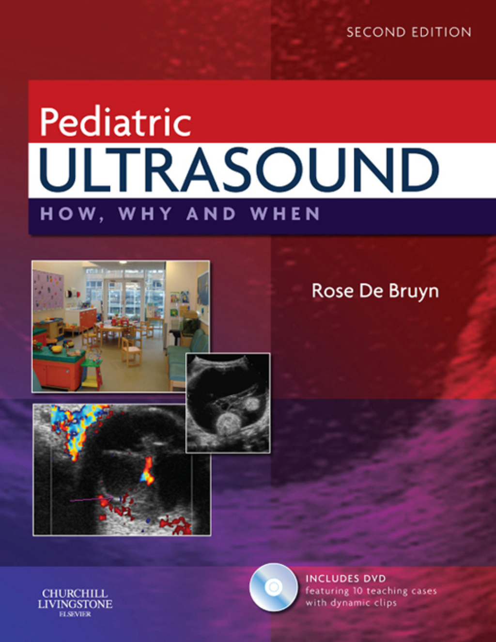 Pediatric Ultrasound How, Why and When 2nd Edition