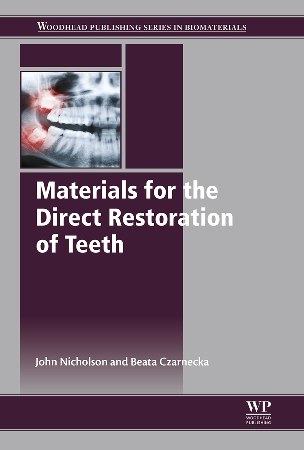 Materials for the Direct Restoration of Teeth 