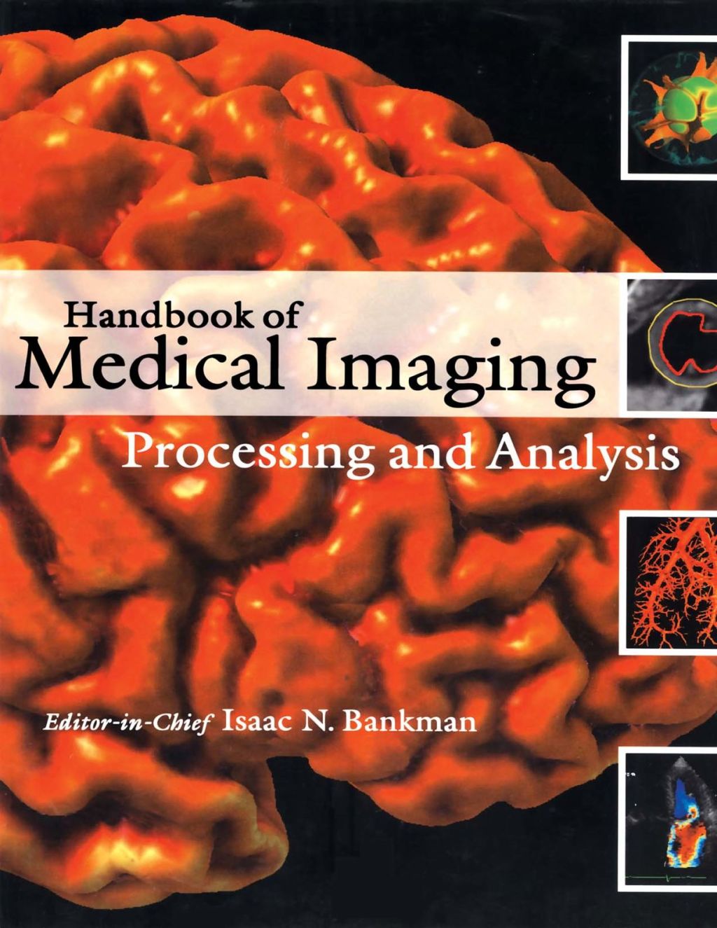Handbook of Medical Imaging: Processing and Analysis Management 