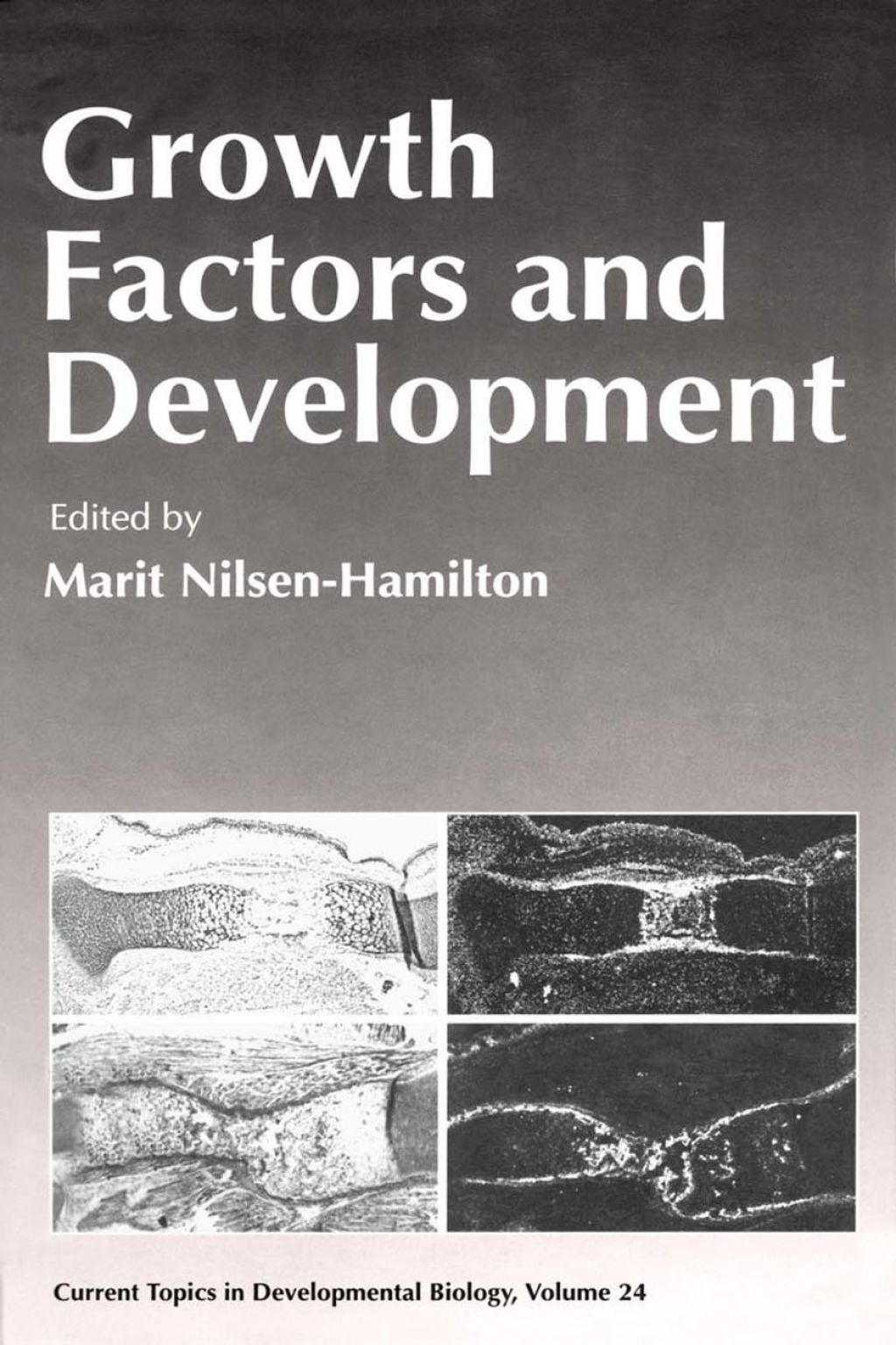 CURRENT TOPICS DEVELOPMENTAL BIOLOGY V24 