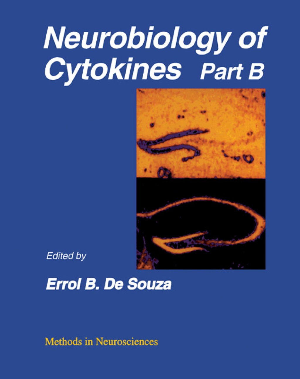 Neurobiology of Cytokines: Volume 17: Neurobiology of Cytokines Part B 