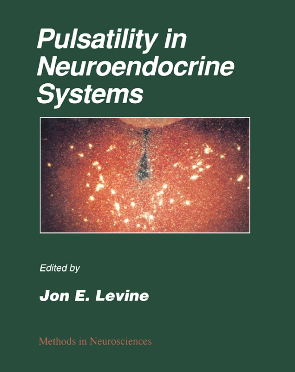 Pulsatility in Neuroendocrine Systems 