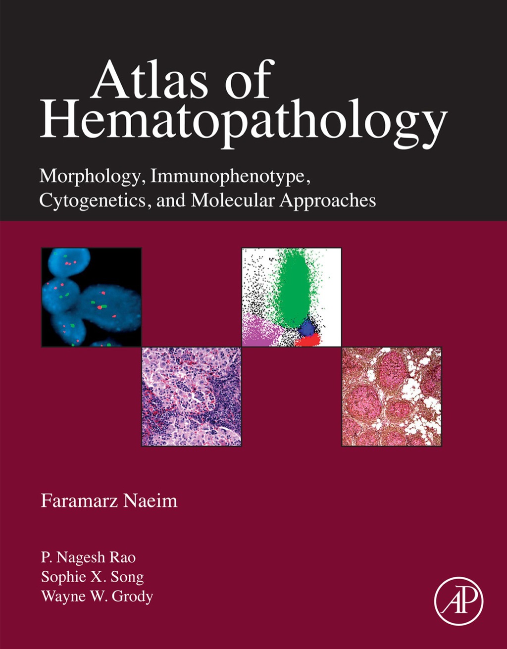 Atlas of Hematopathology: Morphology, Immunophenotype, Cytogenetics, and Molecular Approaches 