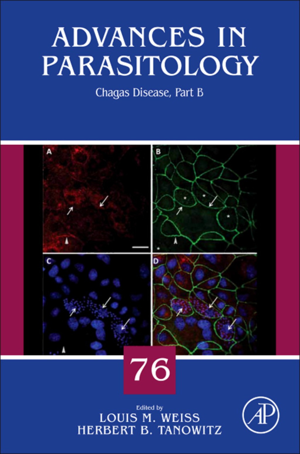 Chagas Disease 