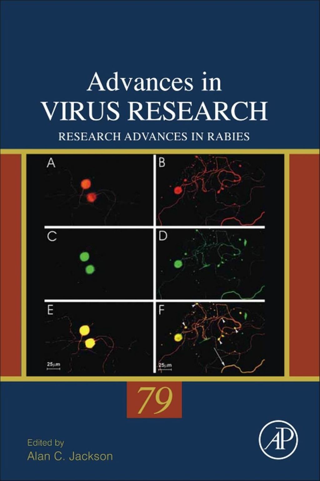 Research Advances in Rabies 