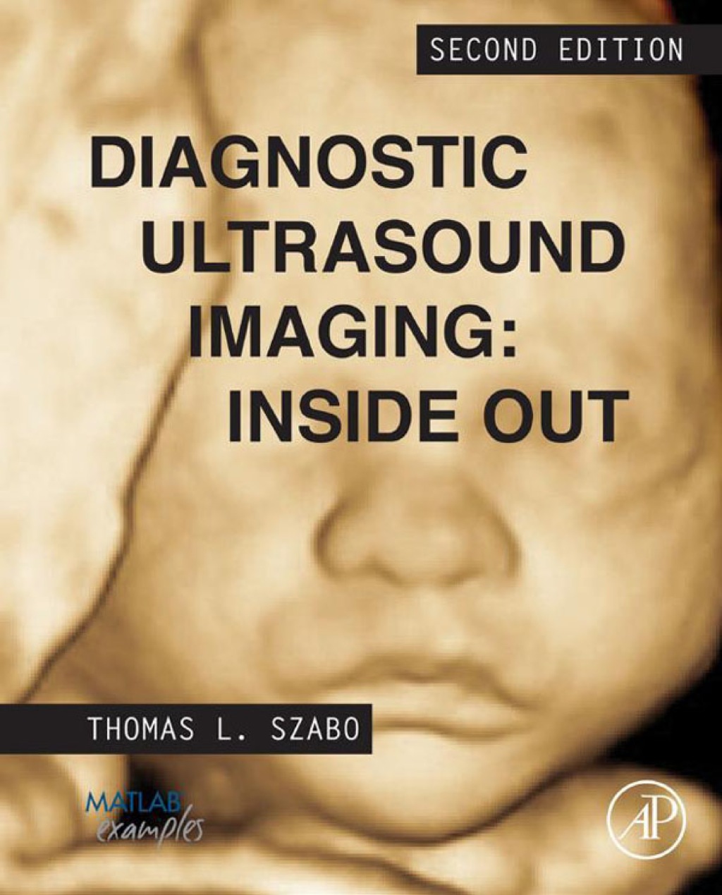 Diagnostic Ultrasound Imaging: Inside Out 2nd Edition