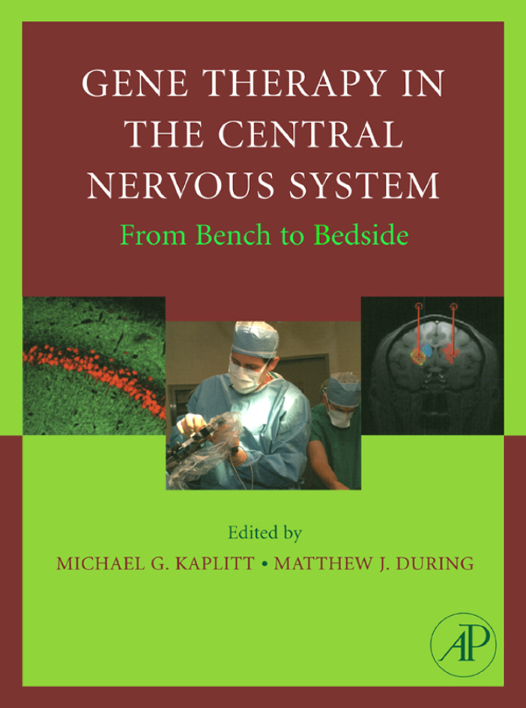 Gene Therapy of the Central Nervous System: From Bench to Bedside 