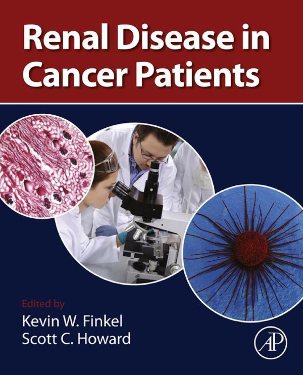 Renal Disease in Cancer Patients 