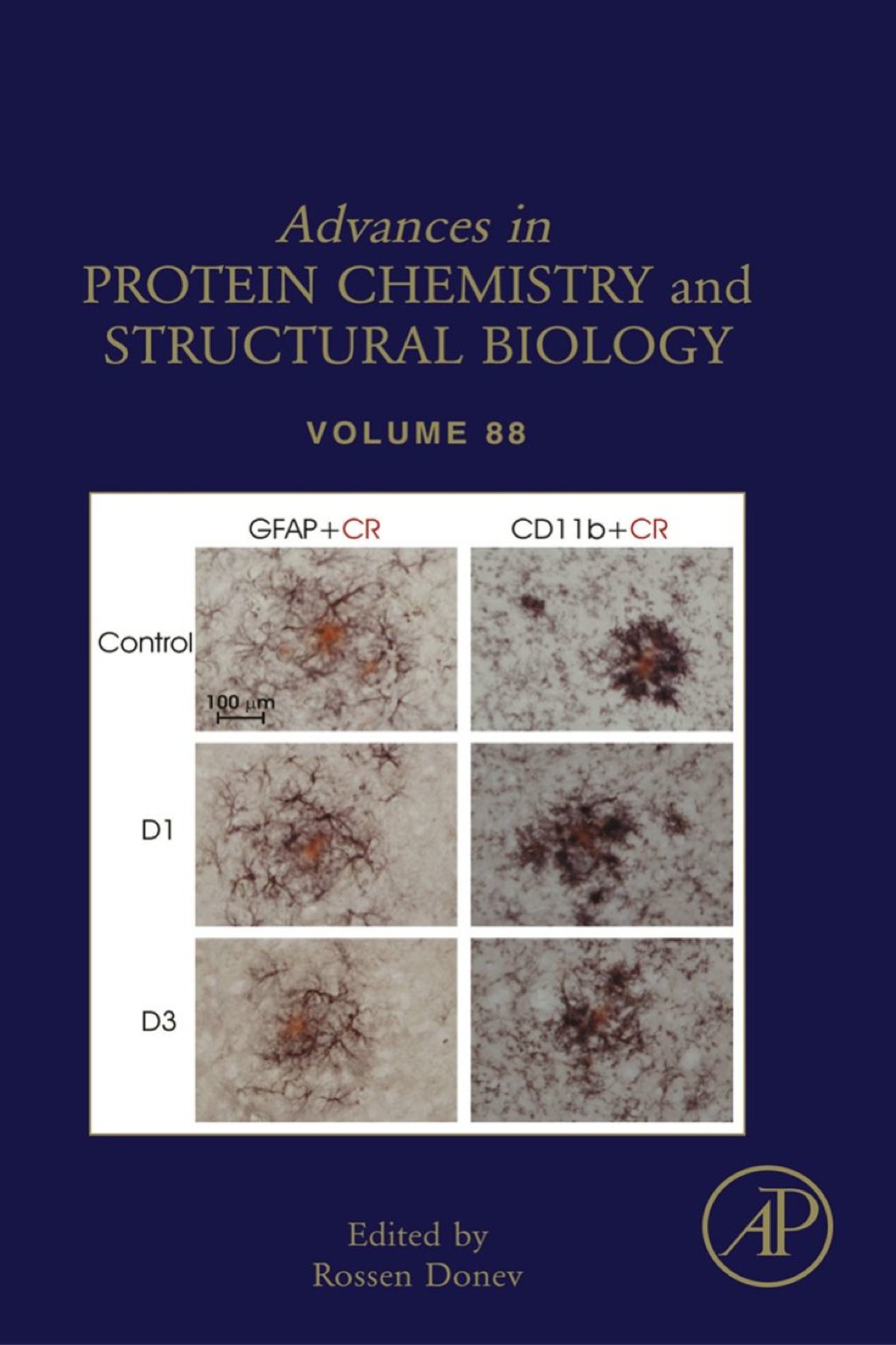 Inflammation in Neuropsychiatric Disorders 