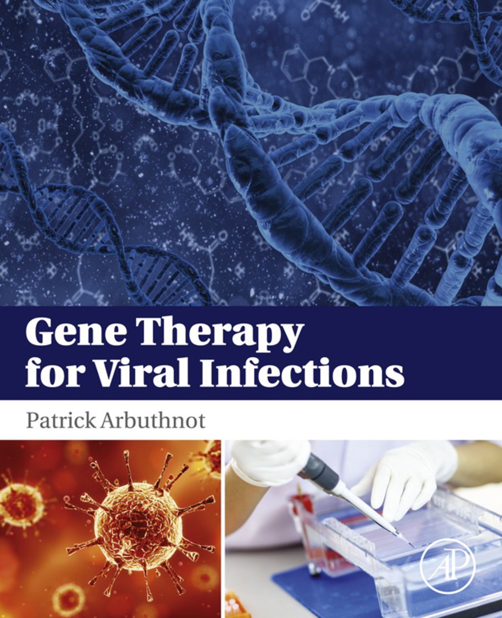 Gene Therapy for Viral Infections 