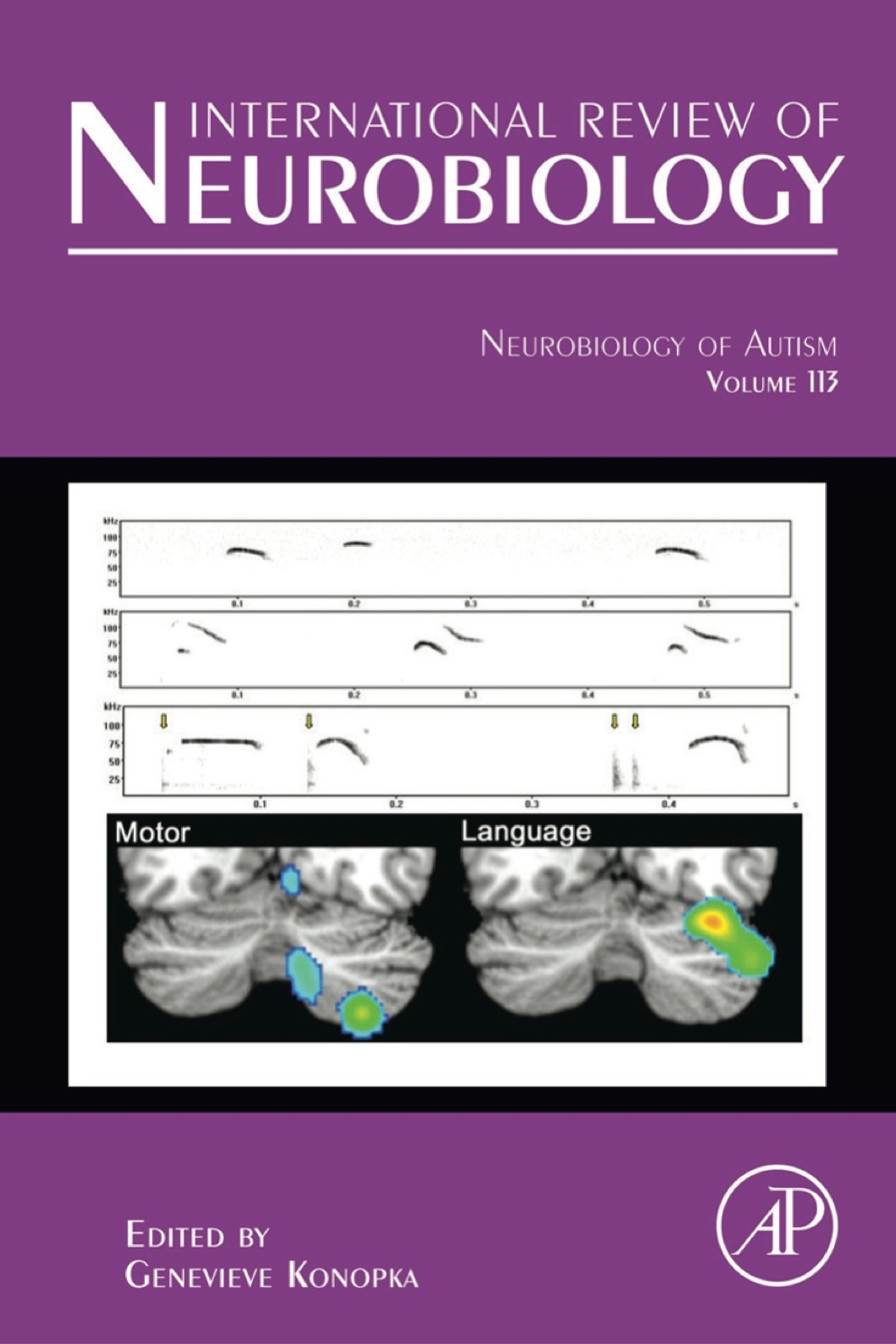 Neurobiology of Autism 