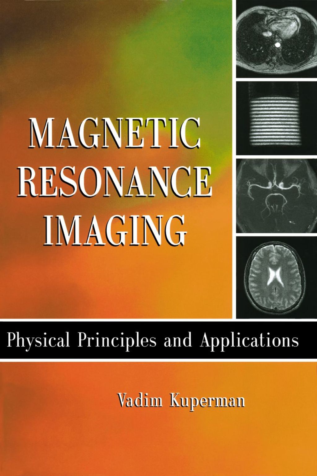 Magnetic Resonance Imaging: Physical Principles and Applications 