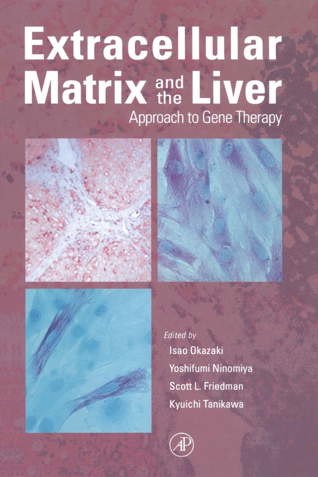 Extracellular Matrix and The Liver: Approach to Gene Therapy 