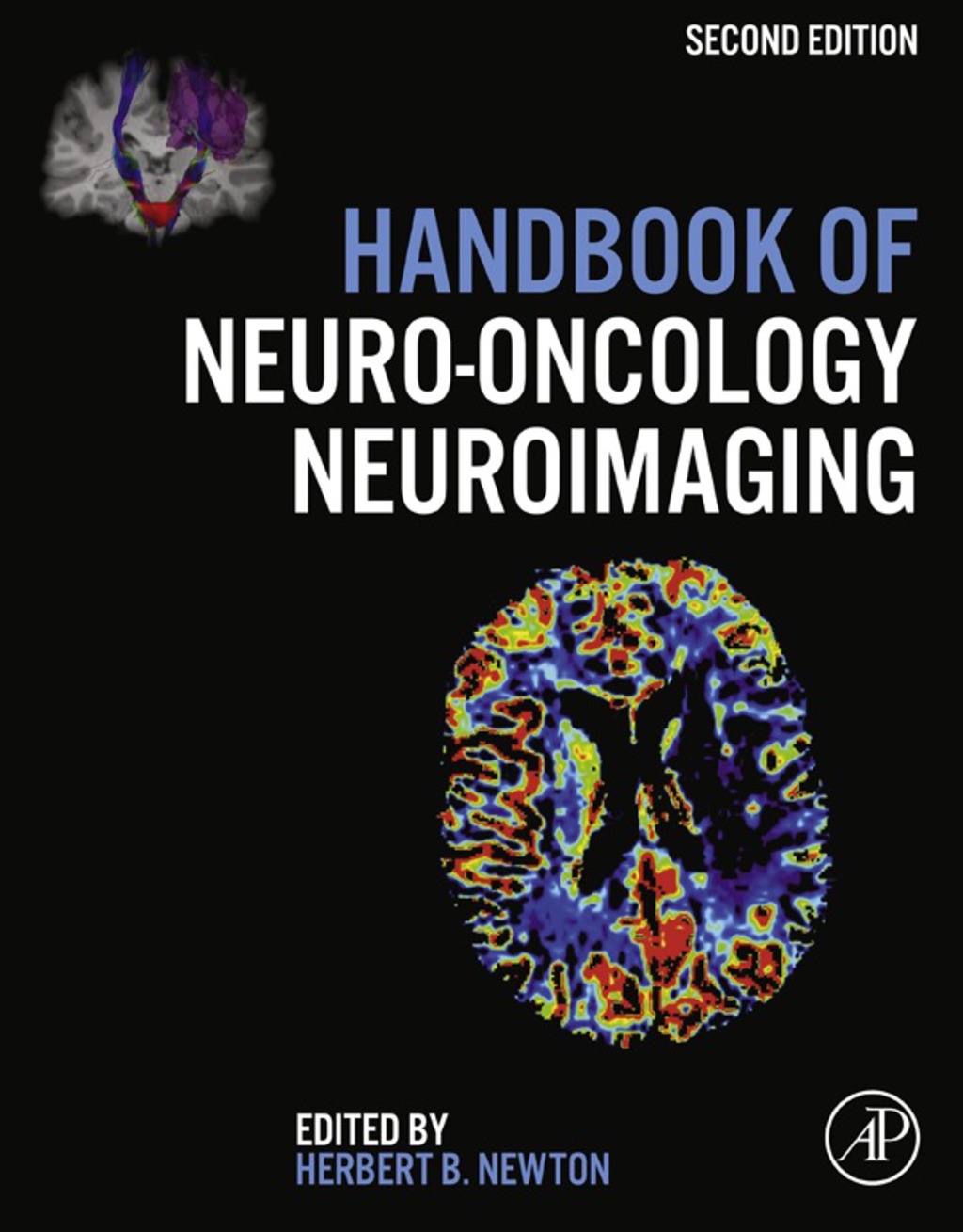 Handbook of Neuro-Oncology Neuroimaging 2nd Edition