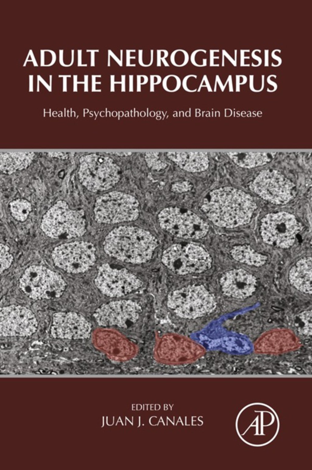 Adult Neurogenesis in the Hippocampus: Health, Psychopathology, and Brain Disease 