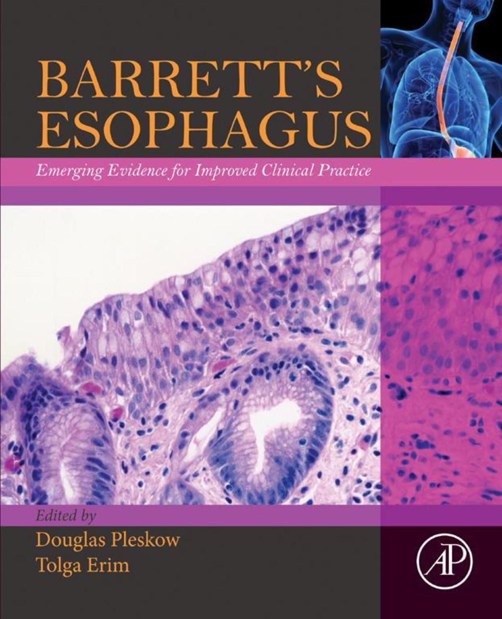 Barrett’s Esophagus 