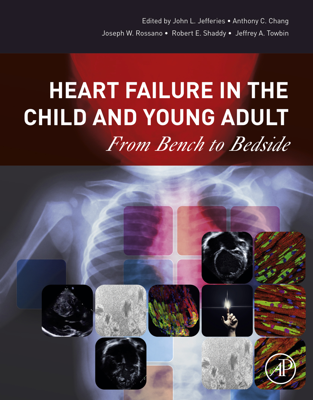 Heart Failure in the Child and Young Adult From Bench to Bedside 