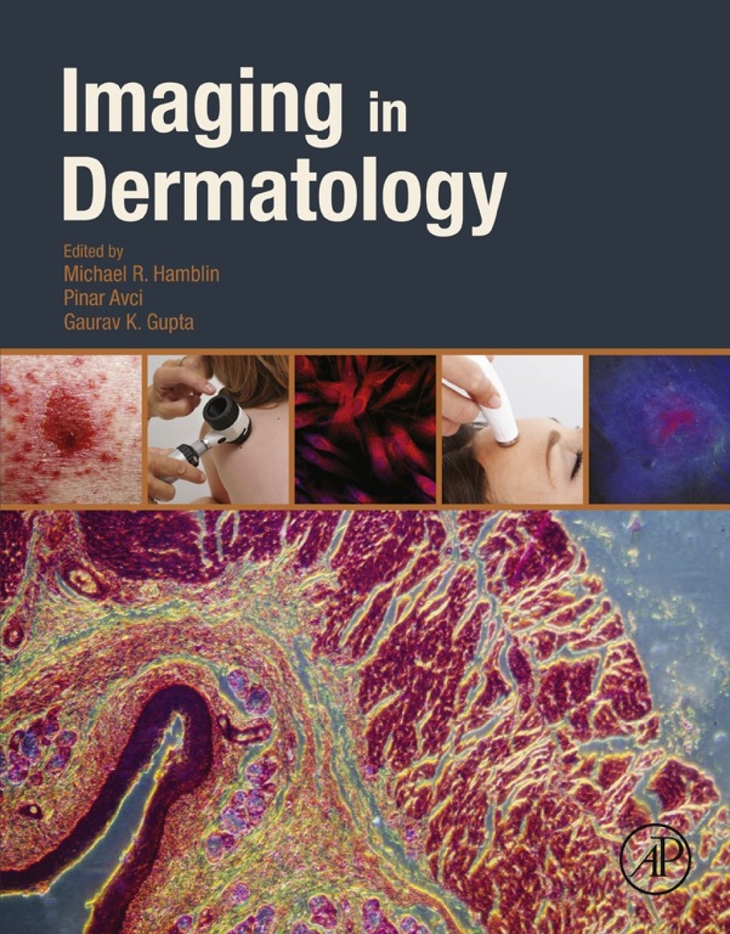 Imaging in Dermatology 
