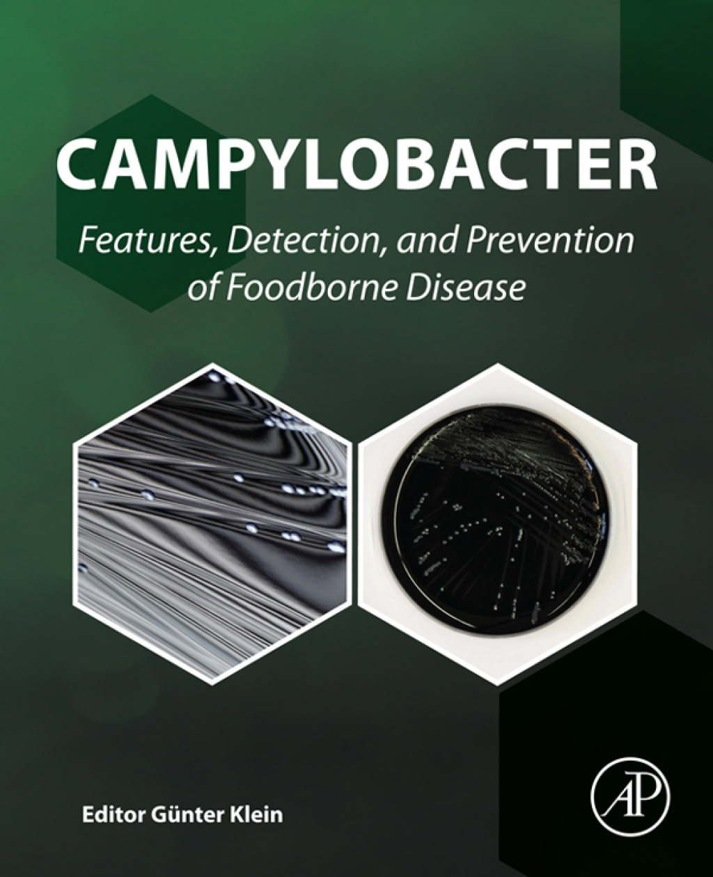 Campylobacter Features, Detection, and Prevention of Foodborne Disease 