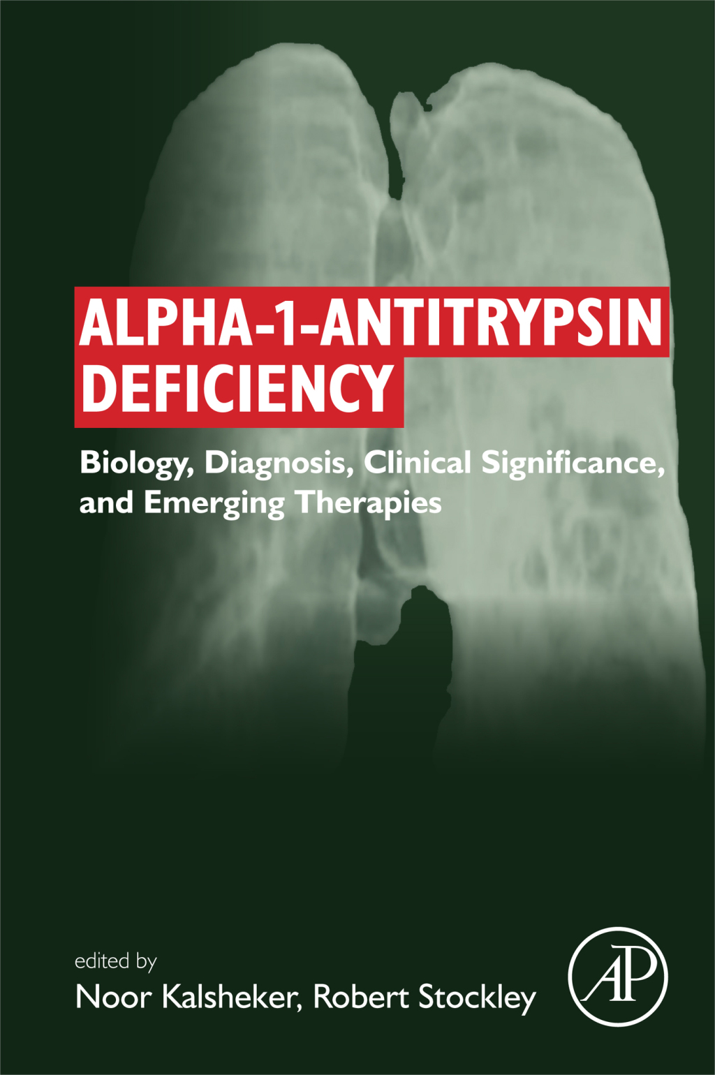 Alpha-1-antitrypsin Deficiency Biology, Diagnosis, Clinical Significance, and Emerging Therapies 