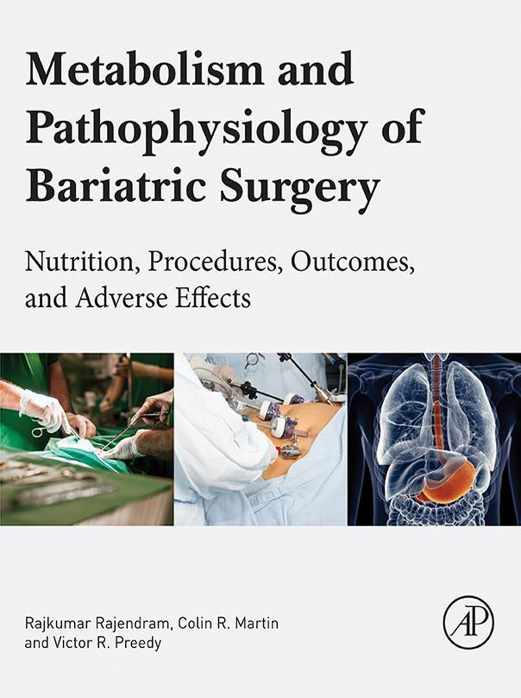 Metabolism and Pathophysiology of Bariatric Surgery Nutrition, Procedures, Outcomes and Adverse Effects 