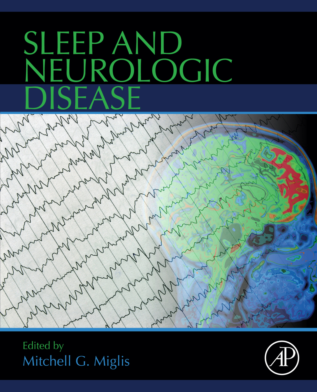 Sleep and Neurologic Disease 