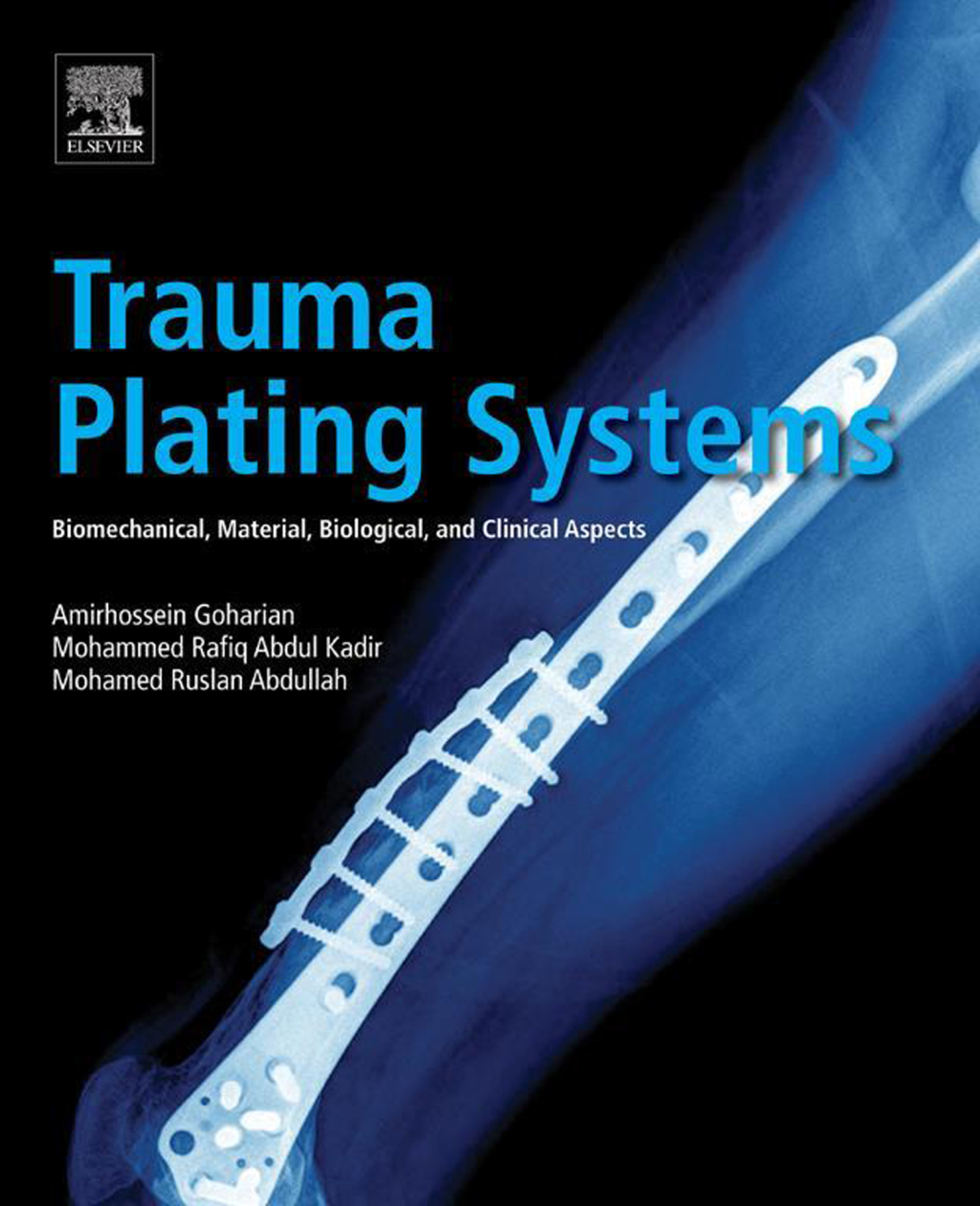 Trauma Plating Systems Biomechanical, Material, Biological, and Clinical Aspects 