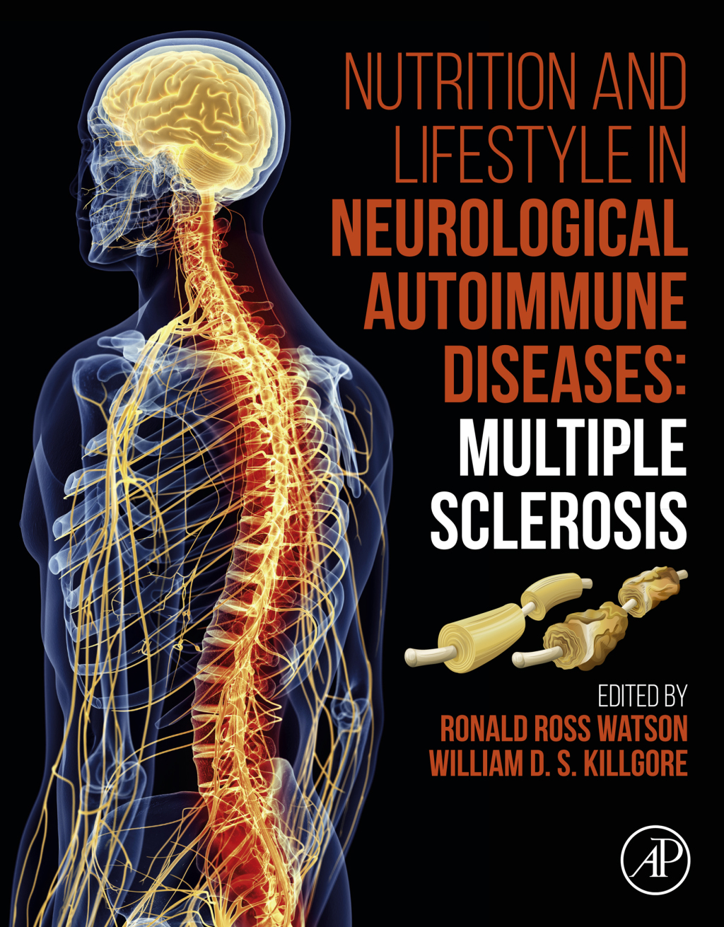 Nutrition and Lifestyle in Neurological Autoimmune Diseases Multiple Sclerosis 