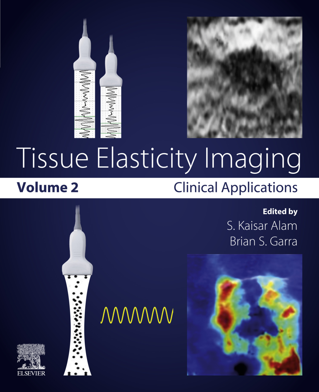 Tissue Elasticity Imaging Volume 2: Clinical Applications 
