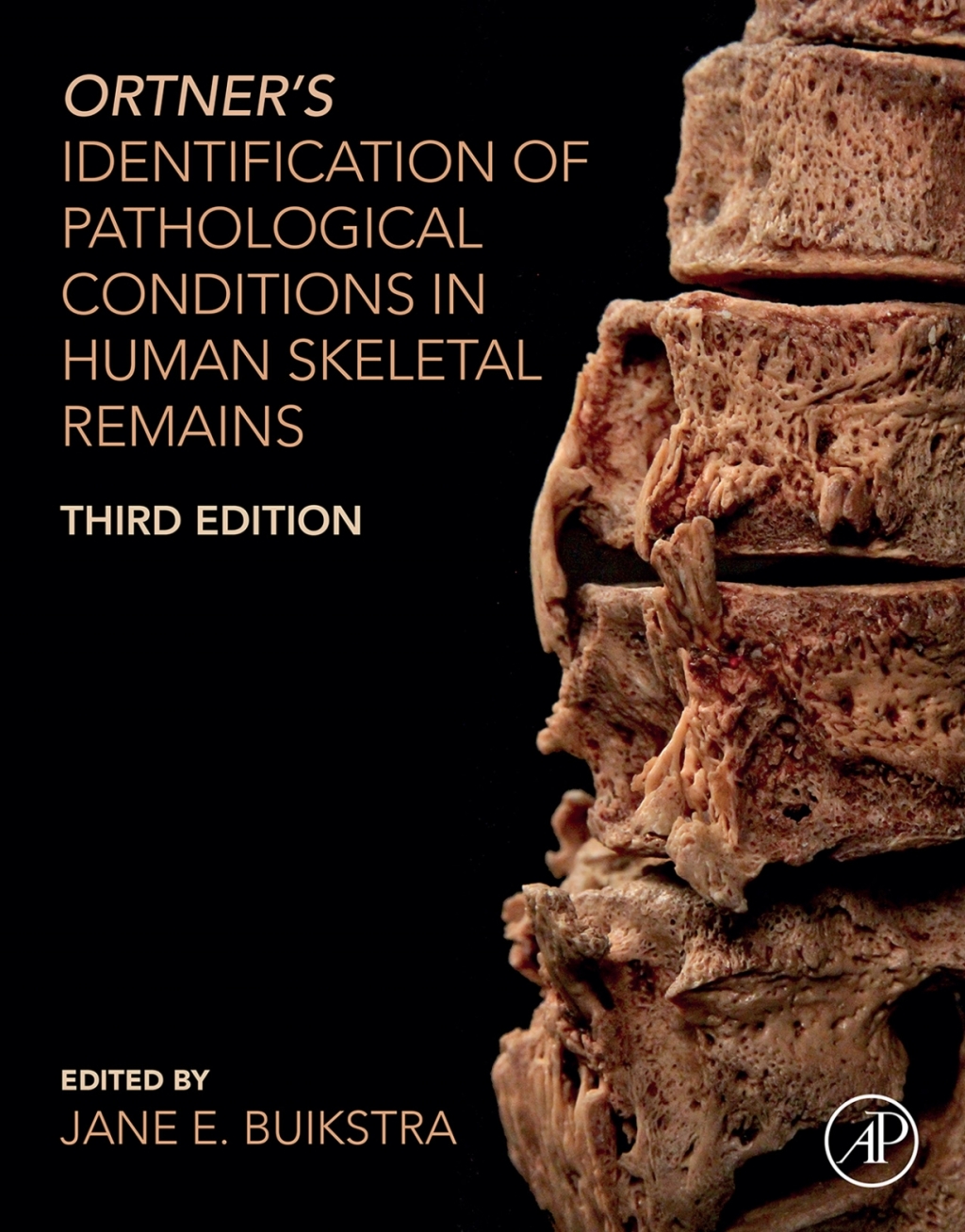 Ortner's Identification of Pathological Conditions in Human Skeletal Remains 3rd Edition