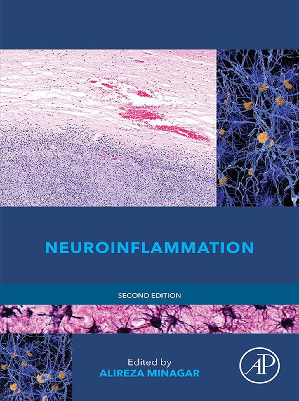 Neuroinflammation 2nd Edition